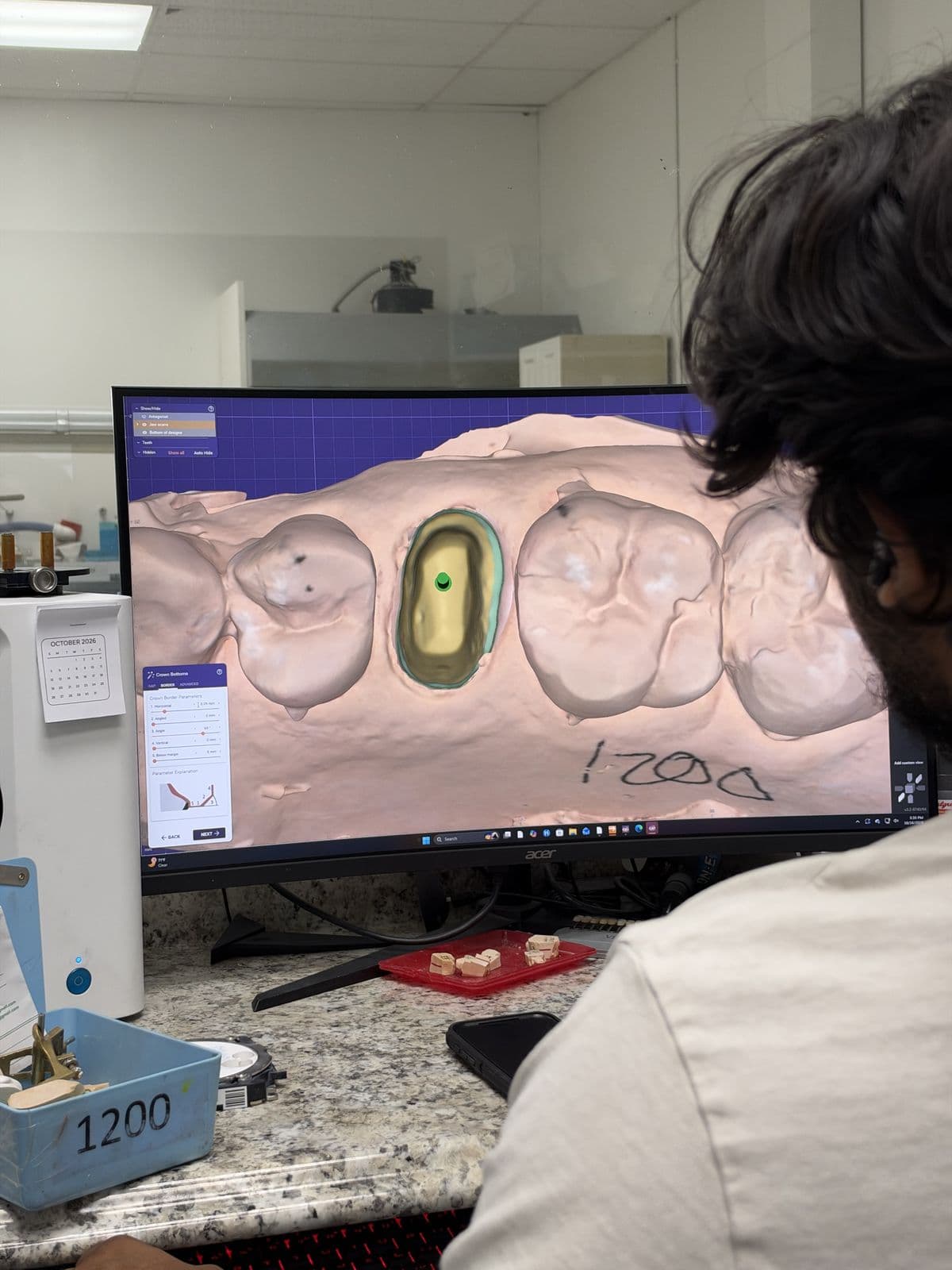 Technician designing a crown on a digital scan at a CAD workstation