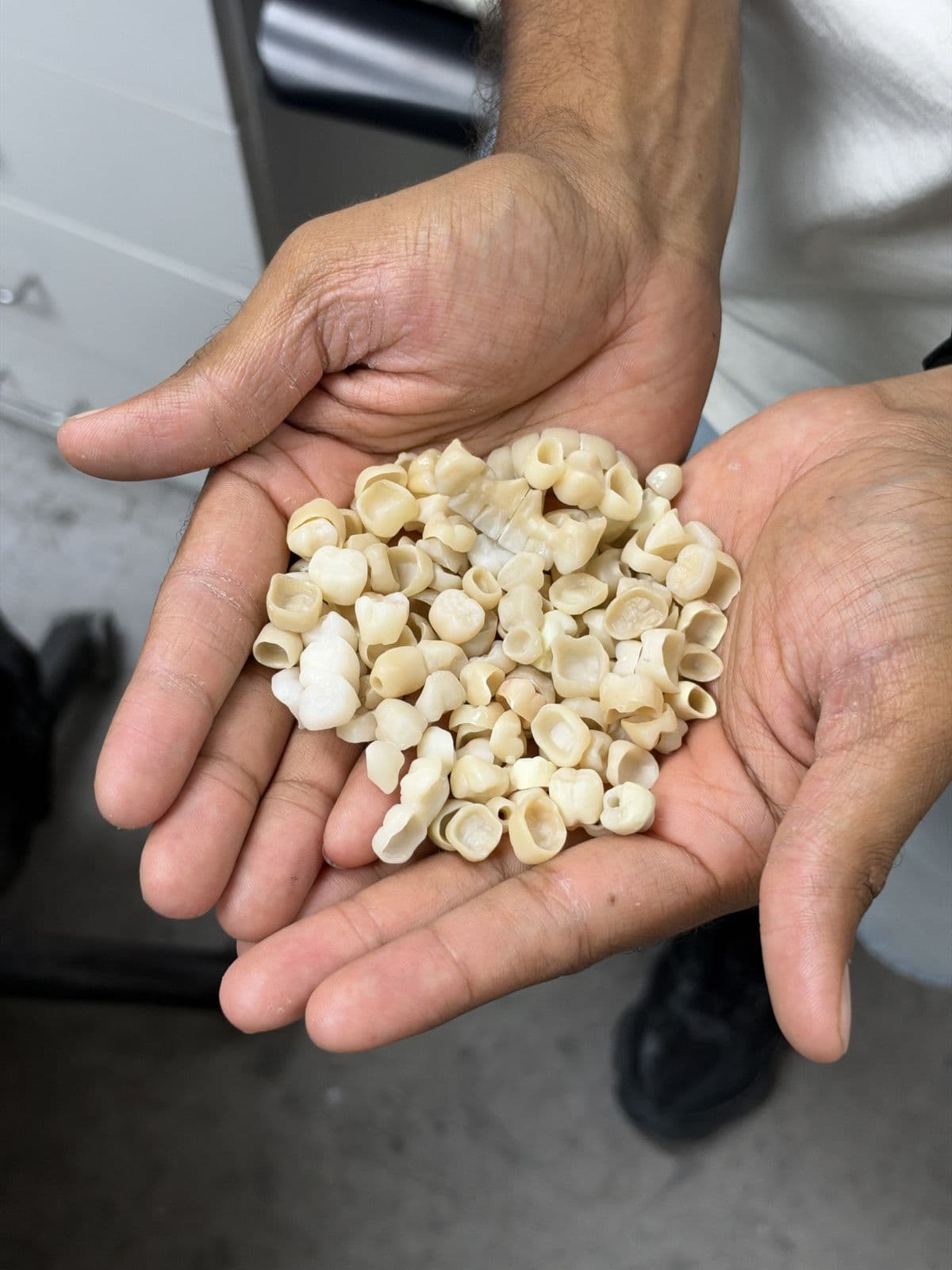 A double handful of finished zirconia crowns
